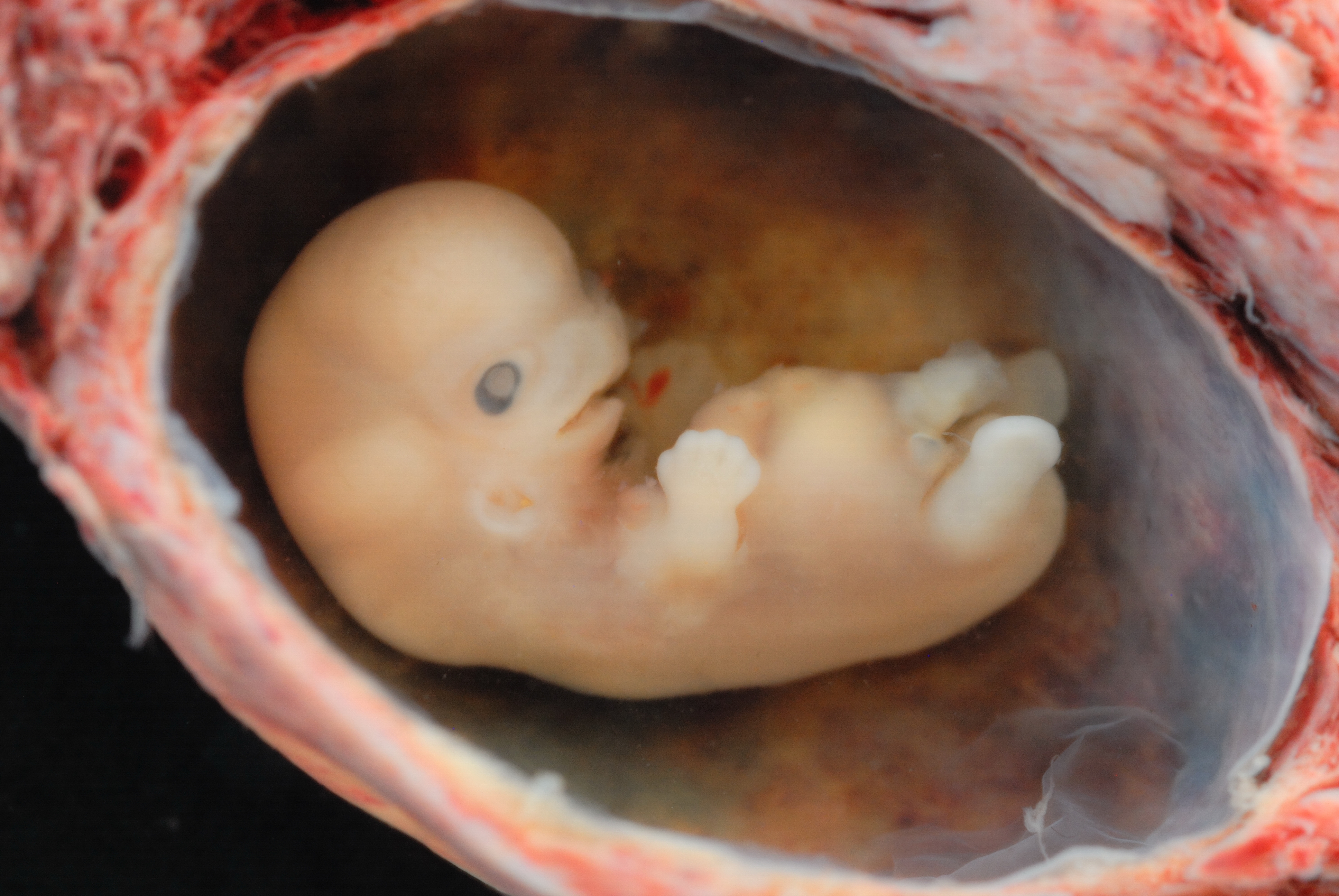 De gruweltoestanden rond abortus - Parbode Sneak Peek