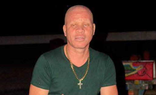 Albino’s in Suriname: ‘Wij hebben ook recht op leven!’ - Parbode Sneak Peek